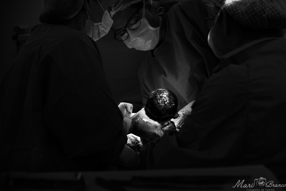 Fotografia de parto normal cesárea na maternidade hospital Paster e Perinatal