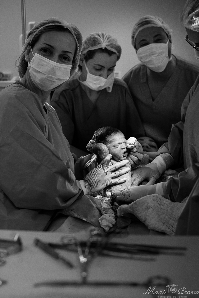 Fotografia de parto normal cesárea na maternidade hospital Paster e Perinatal