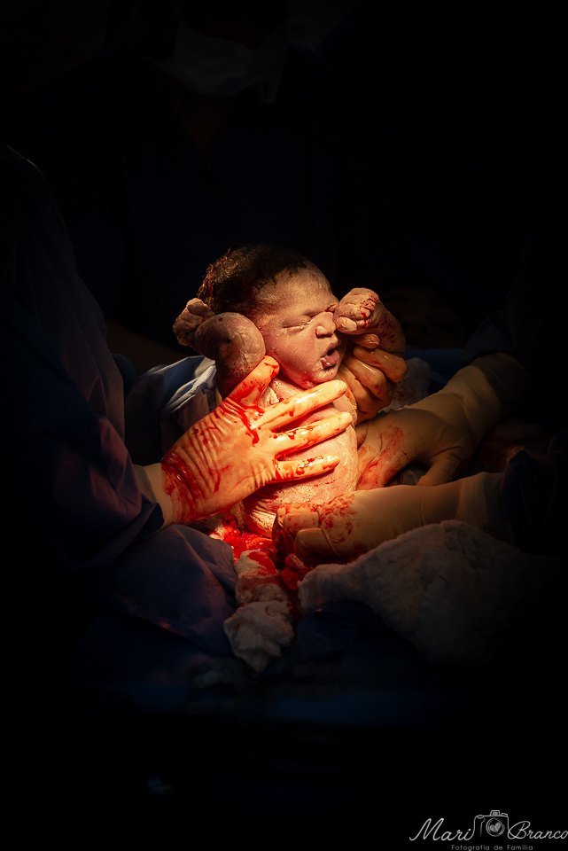 Fotografia de parto normal cesárea na maternidade hospital Paster e Perinatal