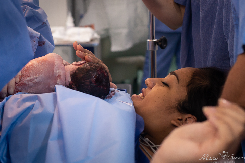 Fotografia de parto normal cesárea na maternidade hospital Paster e Perinatal
