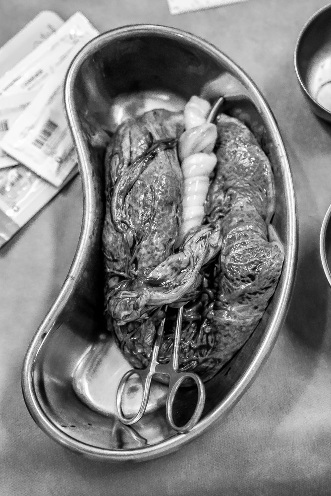 placenta fotos pós parto fotógrafo fabio doria 