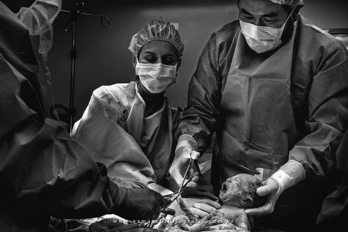 Parto cesarea na maternidade Albert Einstein