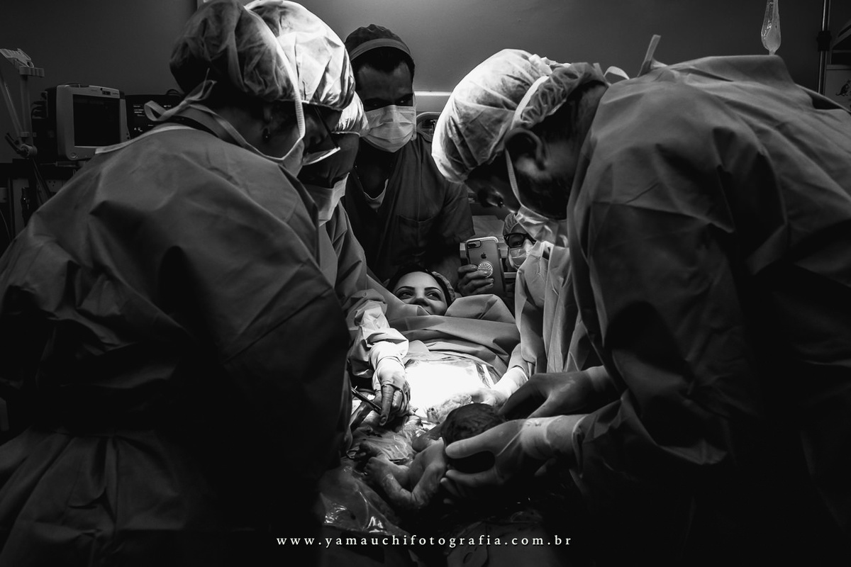 Fotografia de parto cesarea