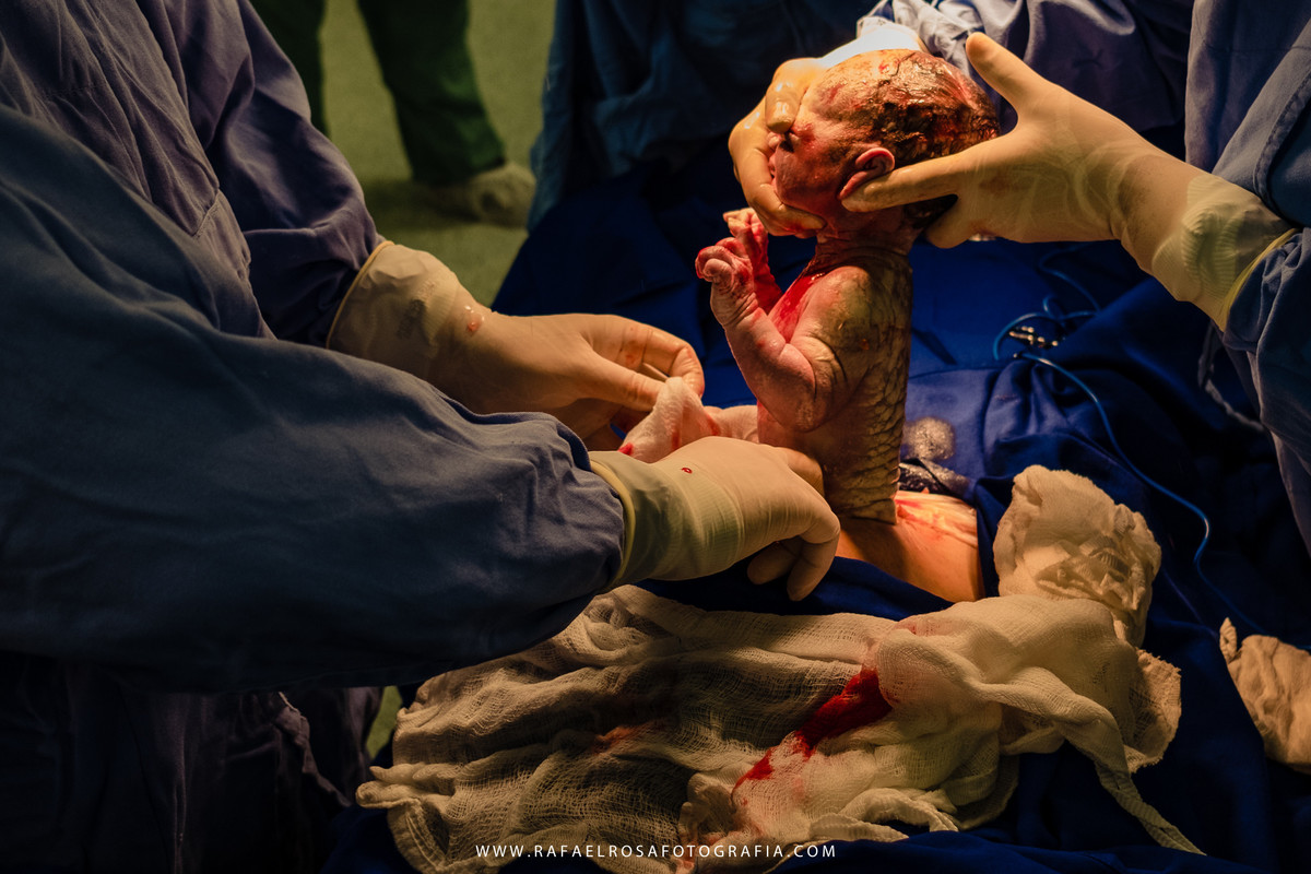 Fotografia documental de parto, nascimento da Mirela  no Hospital Universitário da ULBRA