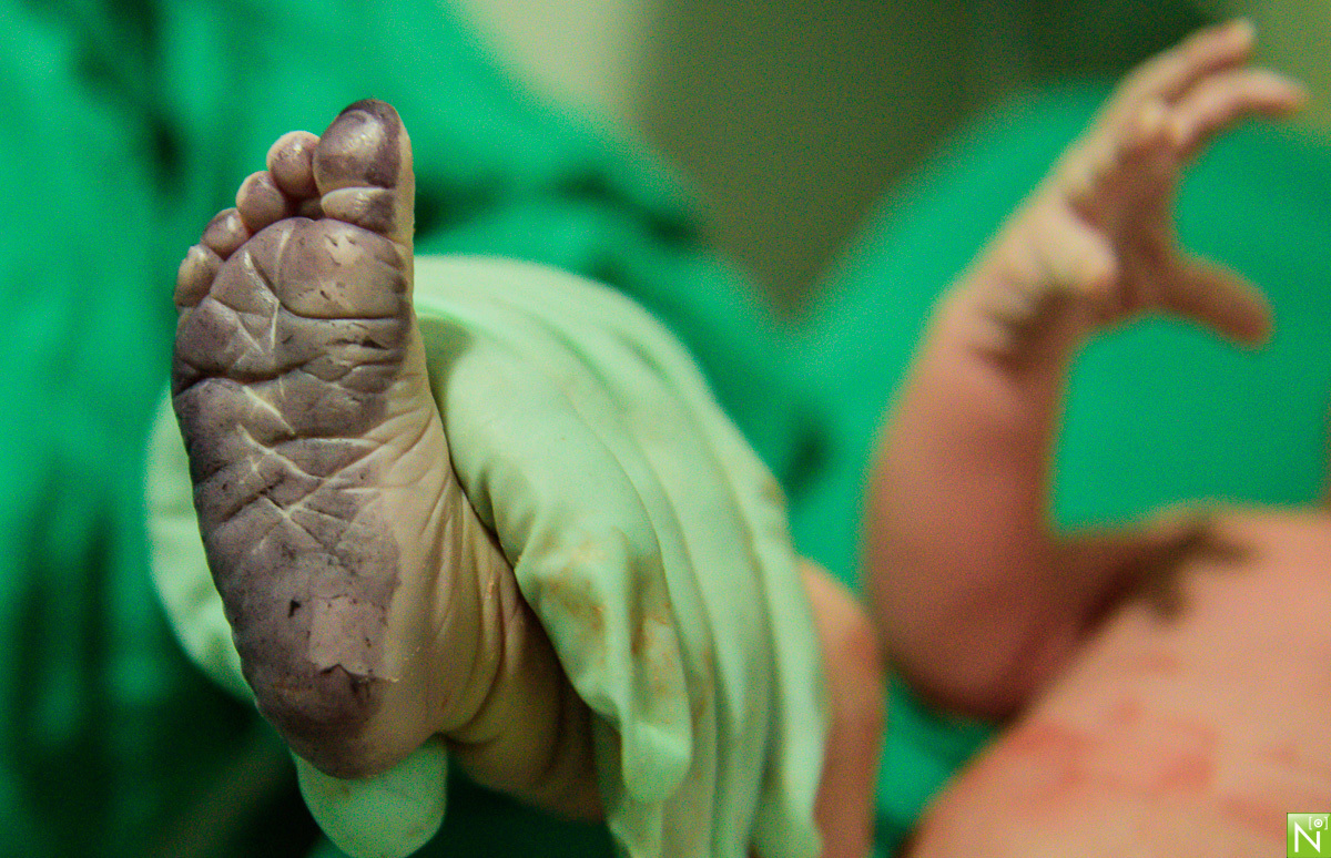 fotografo de parto em maceió, foto de parto em maceió, Fotografia-de-parto, parto-unimed-maceió, parto-Maceió, parto-em-alagoas, foto-parto, parto, fotos criativas pré wedding, trash the dress Maceió