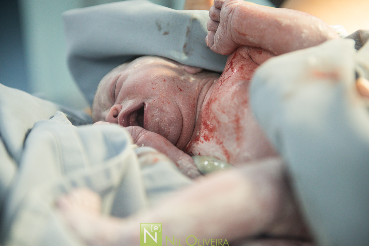 Fotógrafo de casamento Maceió, Fotógrafo Maceió, Fotografia-de-parto, parto-hap vida-maceió, parto-Maceió, parto-em-alagoas, foto-parto, parto, fotos criativas, hospital hap vida