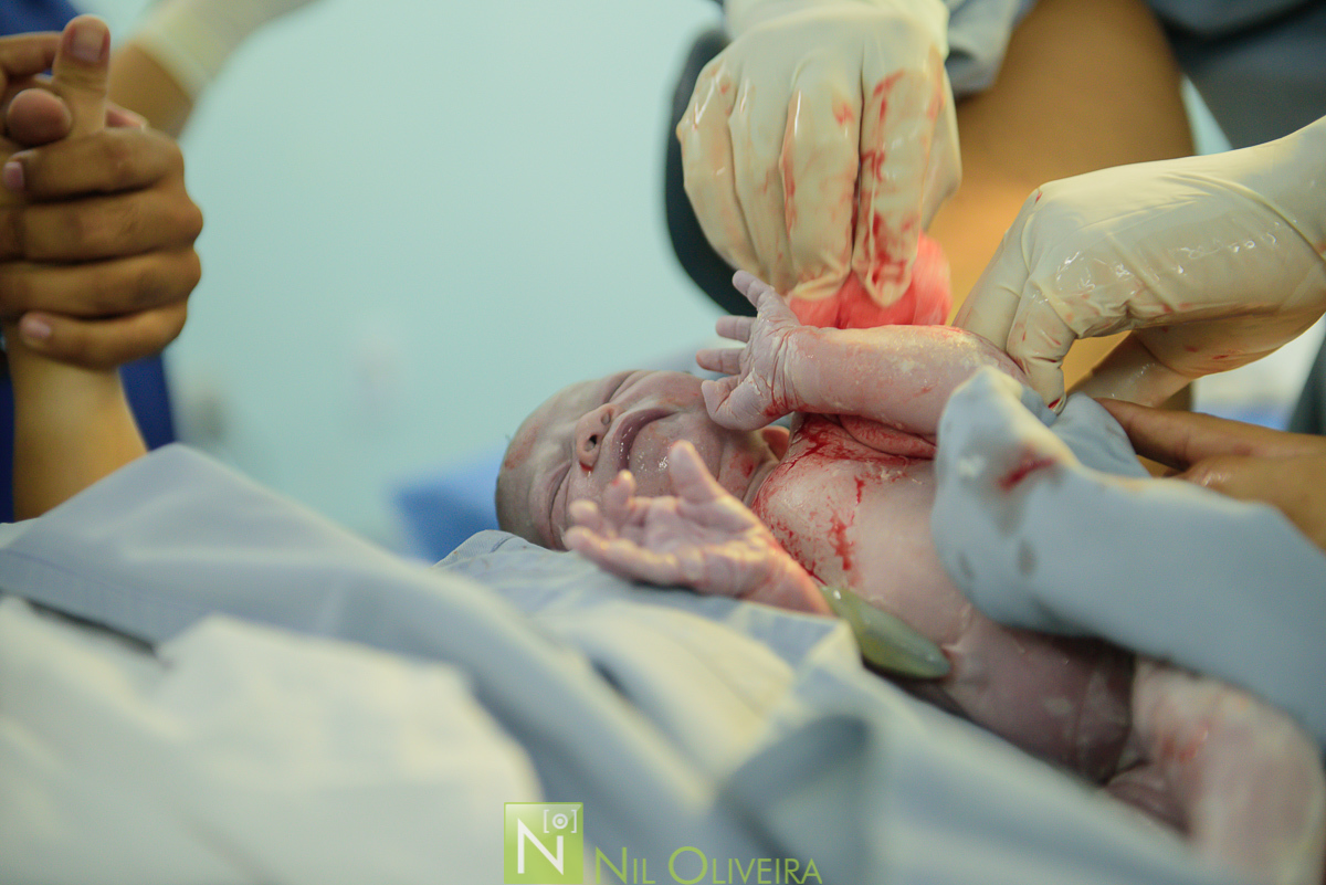 Fotógrafo de casamento Maceió, Fotógrafo Maceió, Fotografia-de-parto, parto-hap vida-maceió, parto-Maceió, parto-em-alagoas, foto-parto, parto, fotos criativas, hospital hap vida