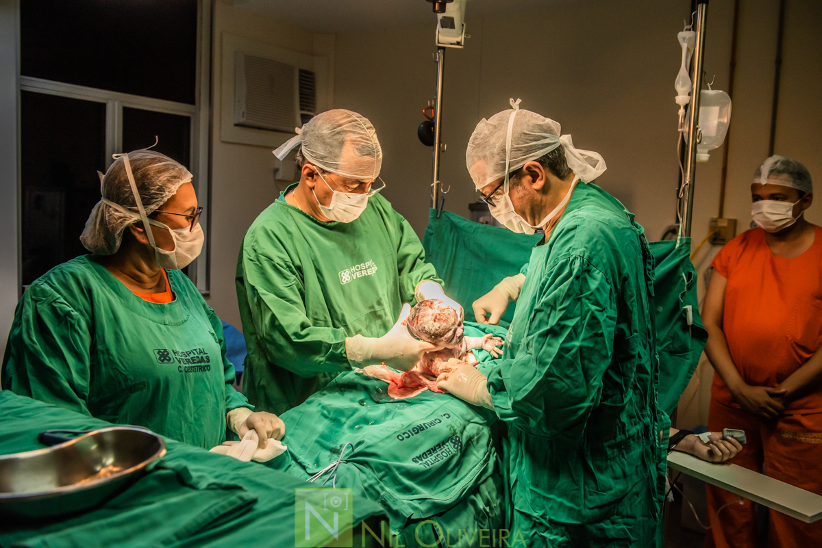Fotógrafo de casamento Maceió, Fotógrafo Maceió, Fotografia-de-parto, parto-hospital veredas-maceió, parto-Maceió, hospital veredas, foto-parto, dr antonio carlos moraes obstetra maceió