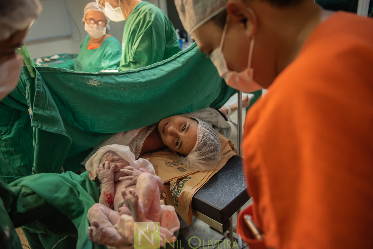 Fotógrafo de casamento Maceió, Fotógrafo Maceió, Fotografia-de-parto, parto-hospital veredas-maceió, parto-Maceió, hospital veredas, foto-parto, dr antonio carlos moraes obstetra maceió