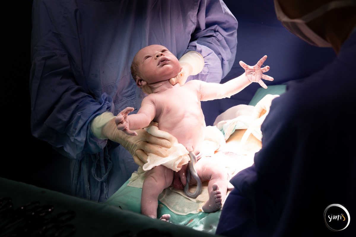 nascimento
cesareana 
parto cesárea 
primeira foto do bebê
vacaria rs
simi's fotografia 