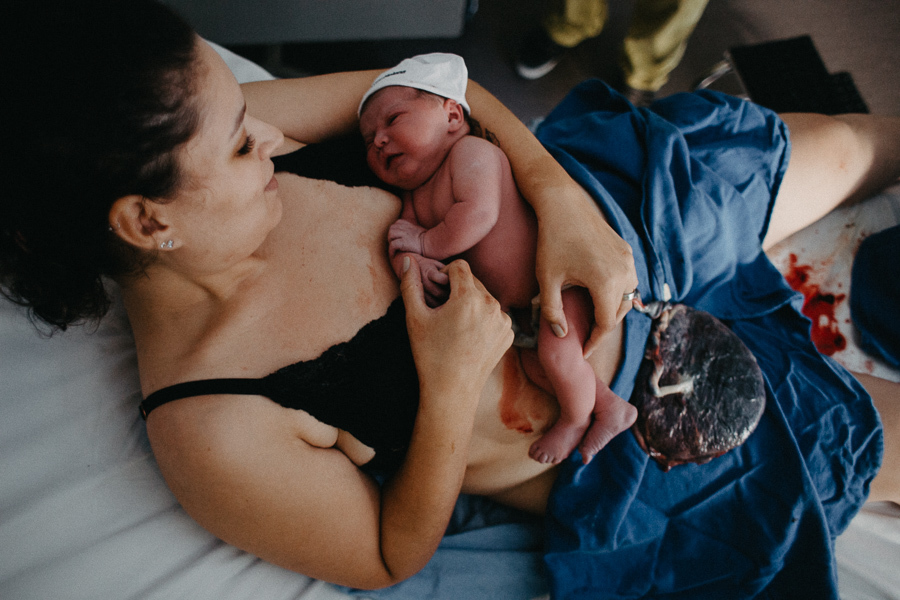 Ligada a placenta