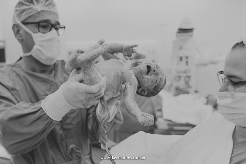 nascimento pedro fotografia parto hospital notre dame guarulhos rafael natany