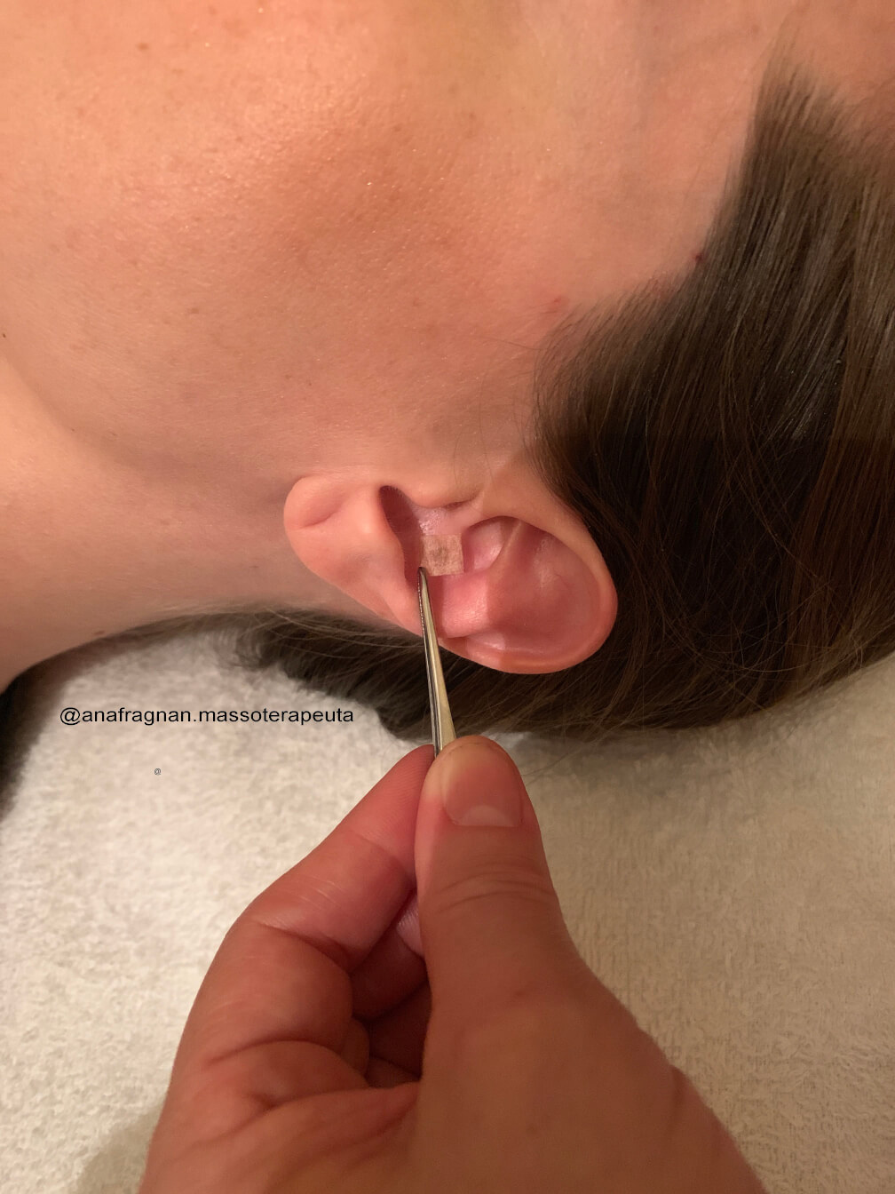 AURICULO TERAPIA EM VALINHOS VINHEDO CAMPINAS SP