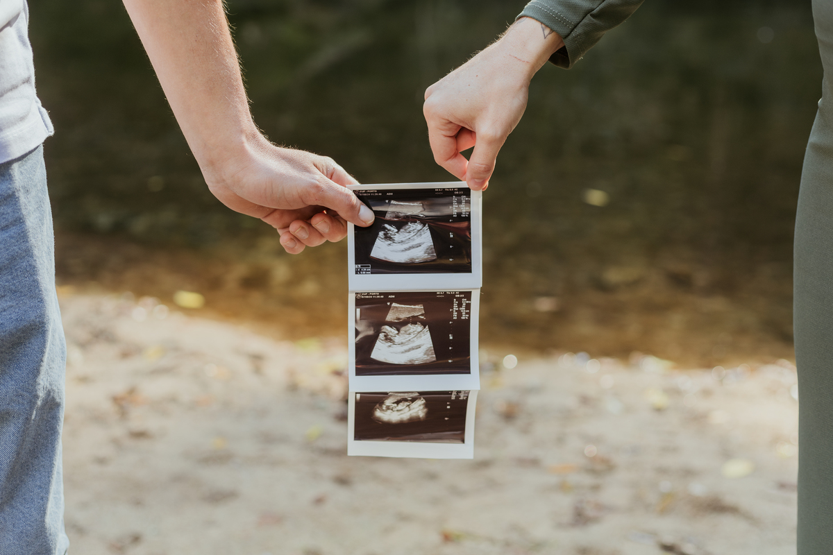 Sessão fotográfica grávida 