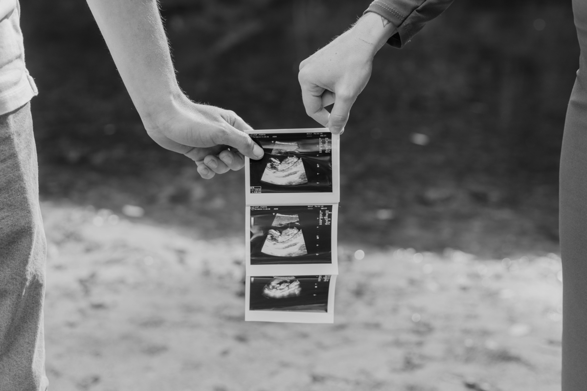 Sessão fotográfica grávida 