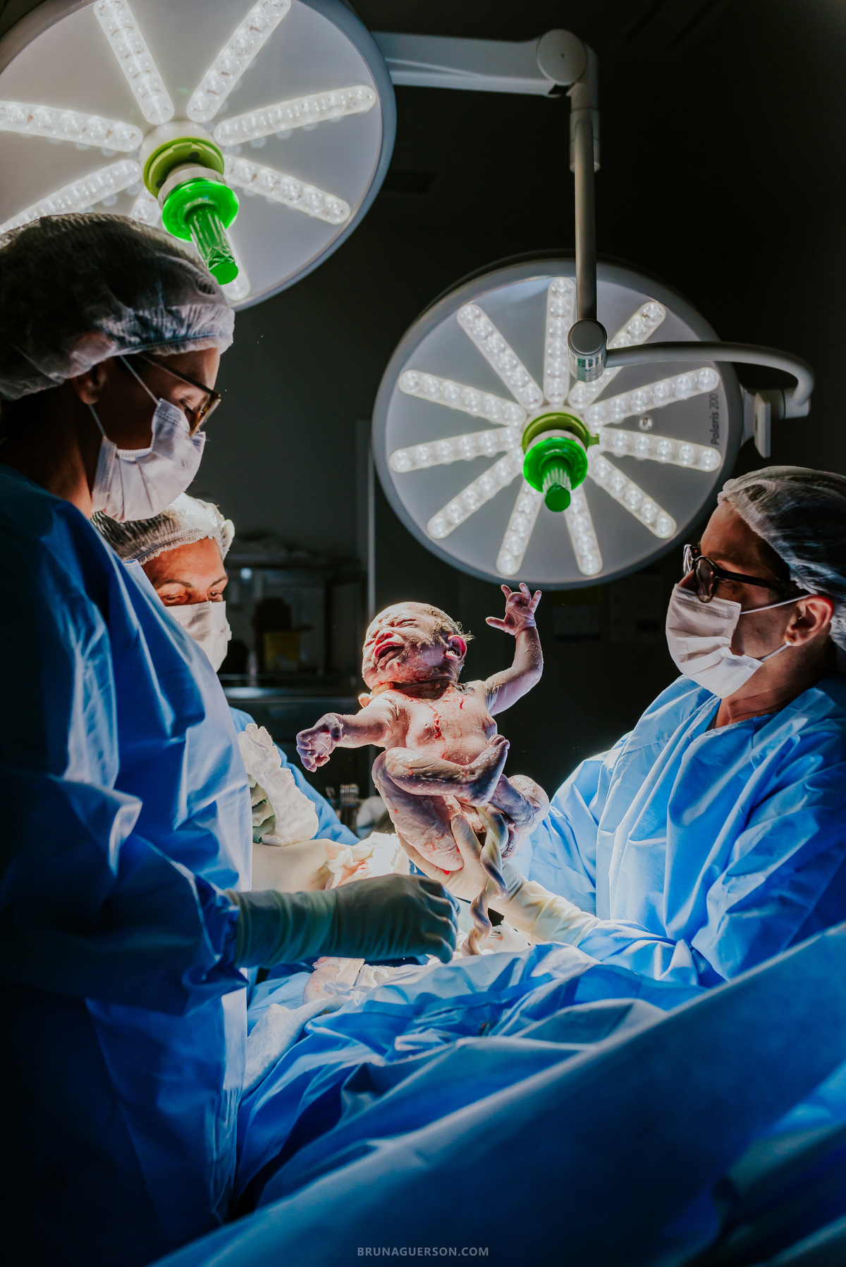 fotografia nascimento fotografa parto cesarea perinatal barra da Tijuca Rio de Janeiro bruna guerson rj 