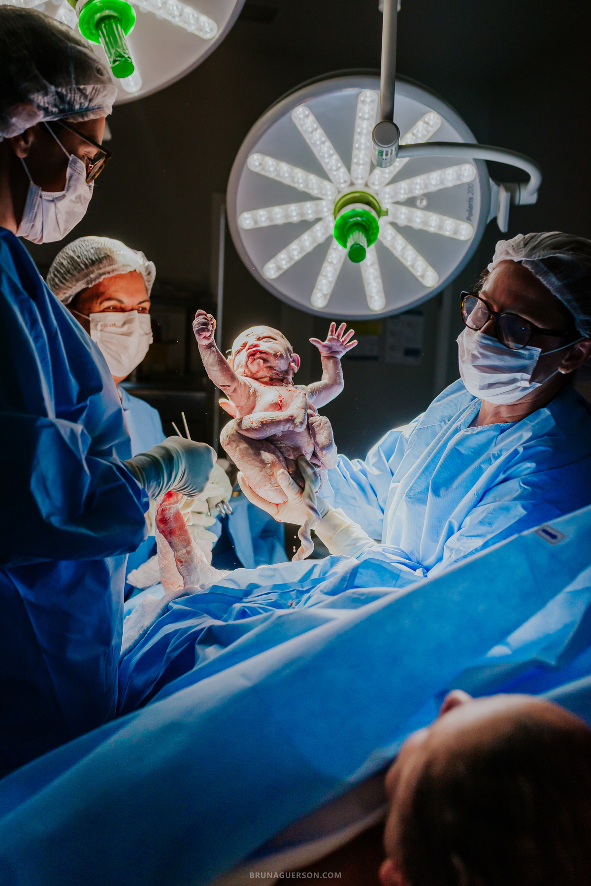 fotografia nascimento fotografa parto cesarea perinatal barra da Tijuca Rio de Janeiro bruna guerson rj 