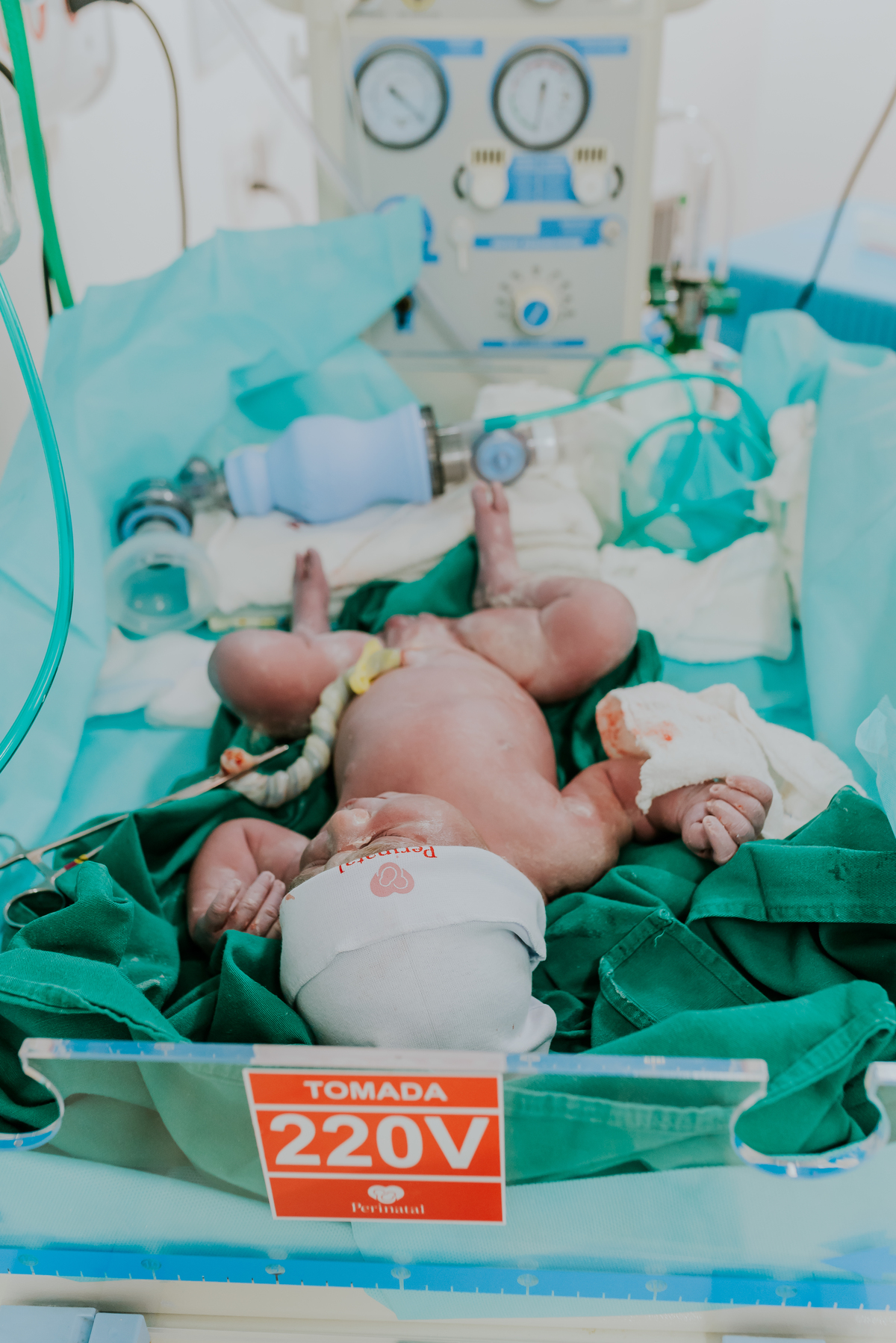 fotografia nascimento perinatal laranjeiras fotografa familia rio de janeiro parto cesárea laura rj