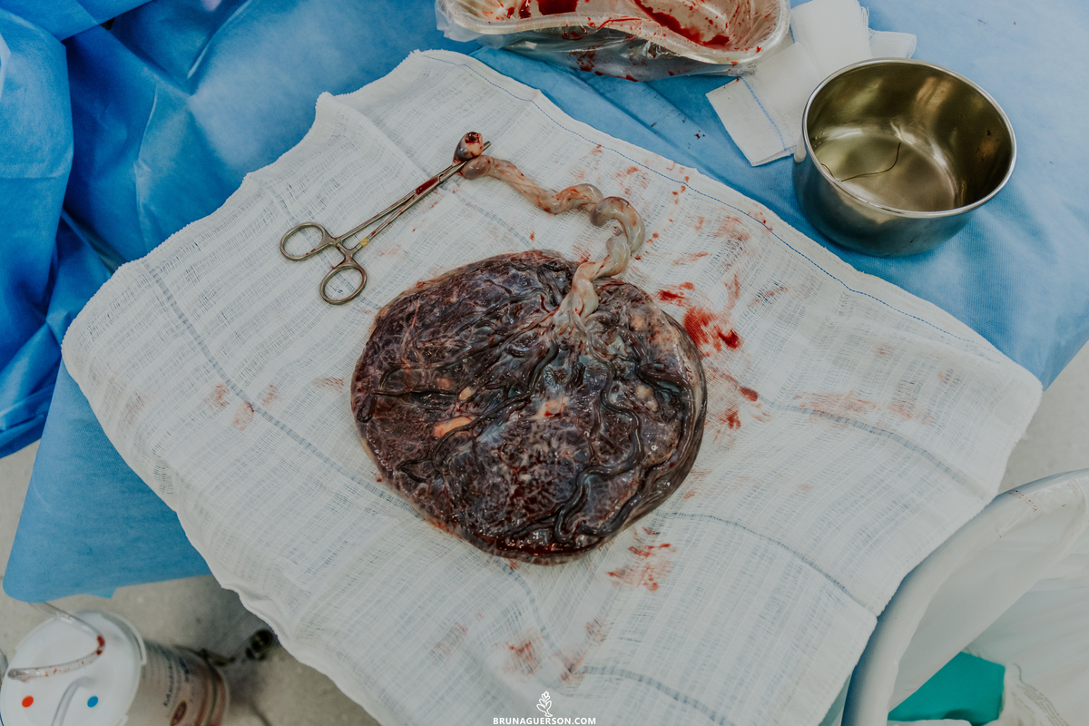 fotografia de parto rio de janeiro bruna guerson maternidade são josé