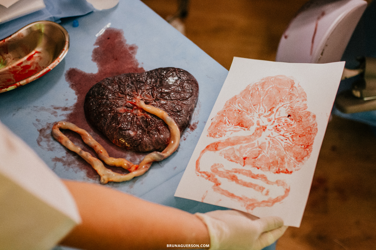 fotografia de parto fotografa rj Rio de Janeiro perinatal laranjeiras perinatal barra da Tijuca parto normal parto humanizado fotos de parto