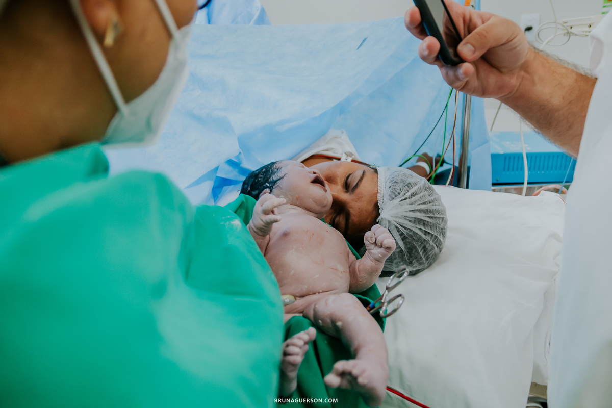 fotografia parto perinatal barra da tijuca cesarea Rio de Janeiro rj fotografa Olivia 