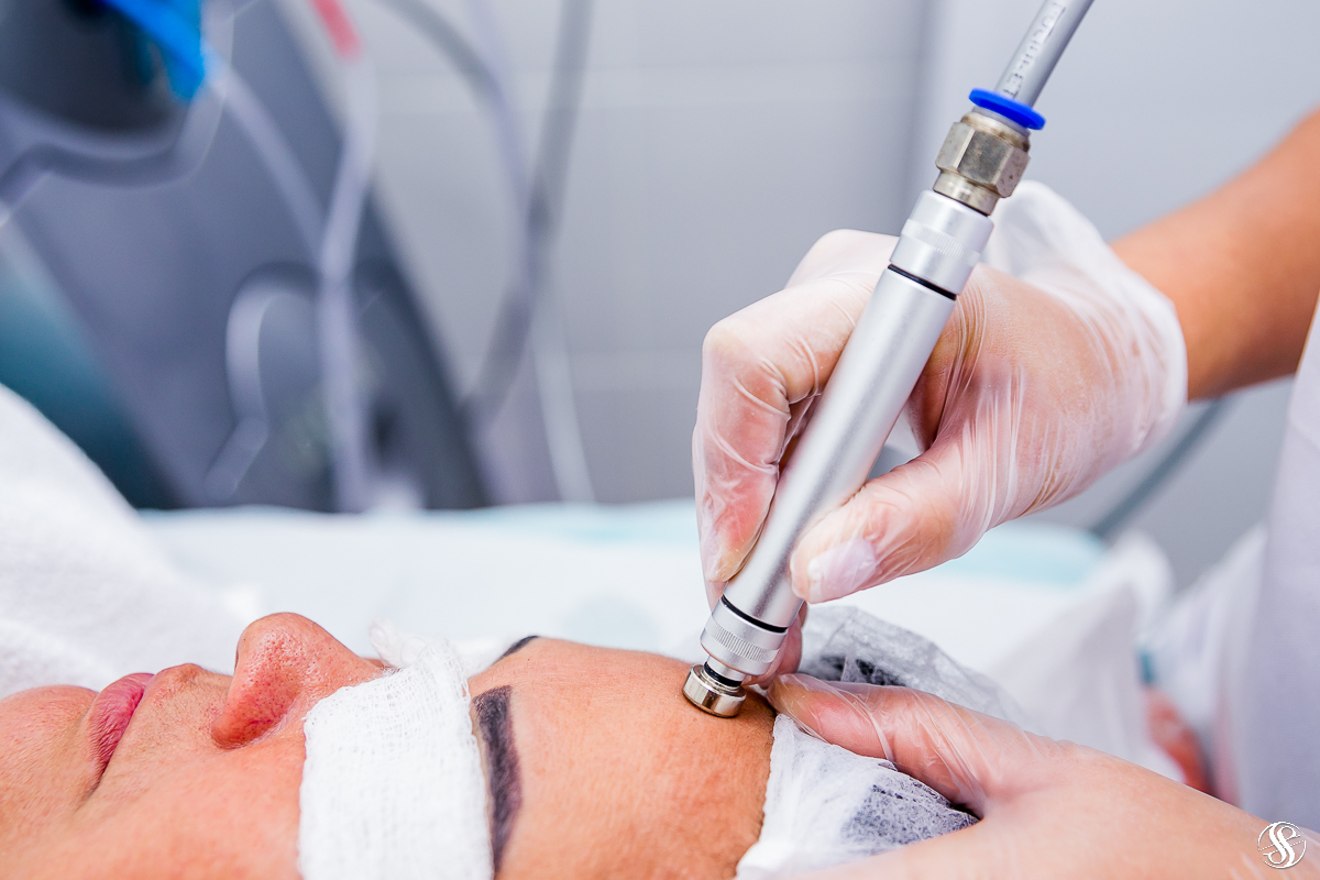 Peeling Diamante e Peeling Cristal em Niterói e no Rio de Janeiro