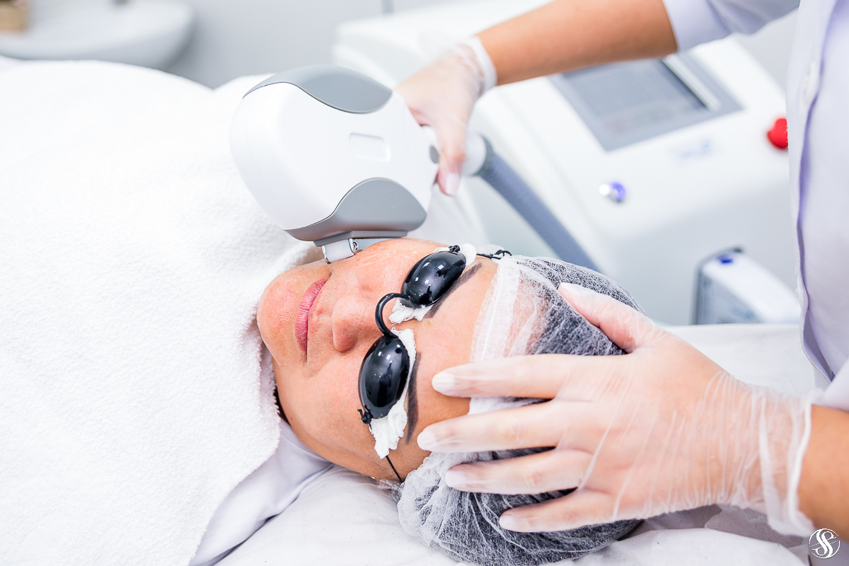 Peeling Diamante e Peeling Cristal em Niterói em São Gonçalo