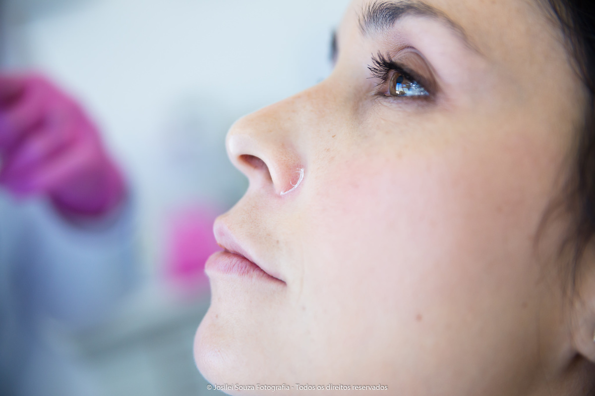 Botox em Ipanema - RJ 