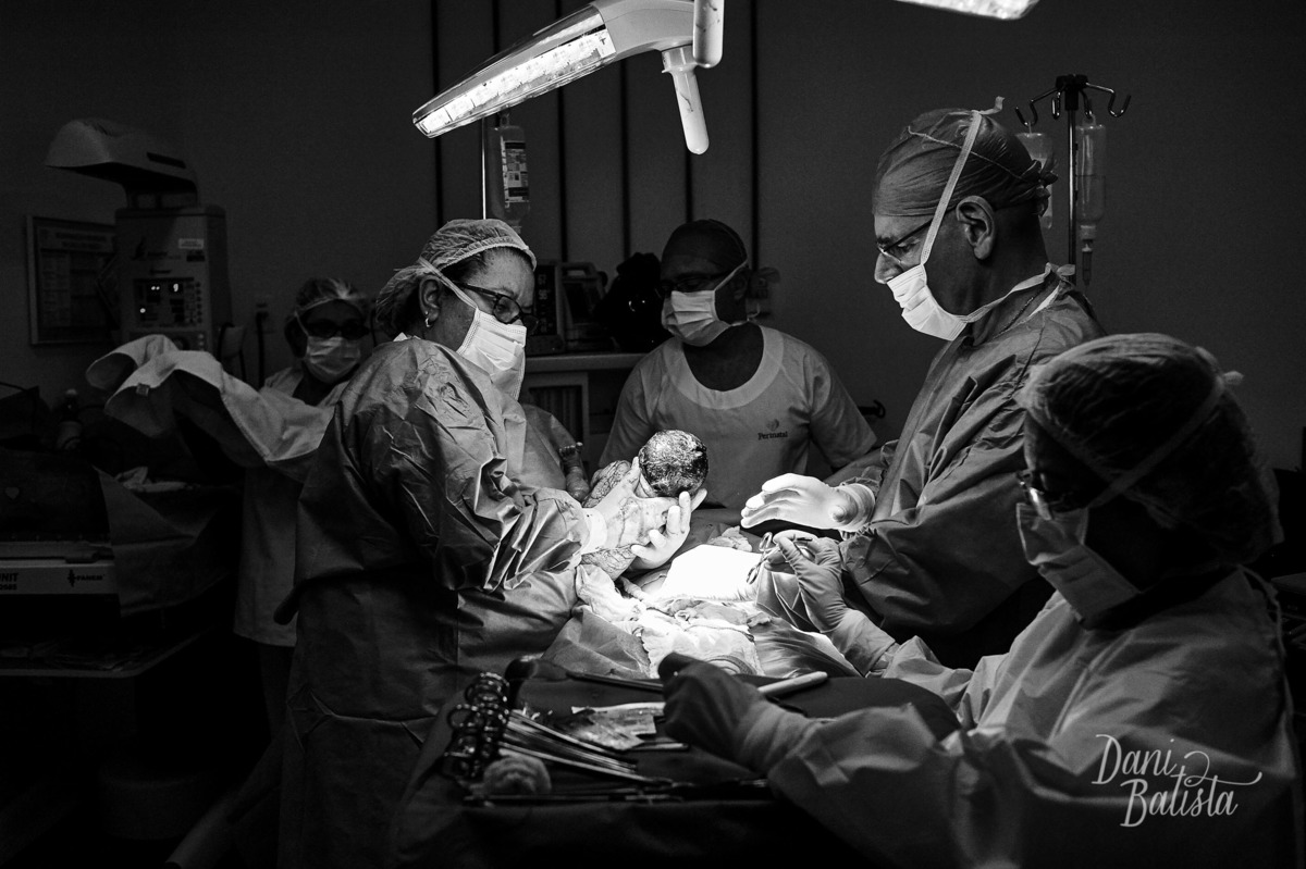 foto preto e branco do nascimento de bebê no parto cesarea perinatal laranjeiras