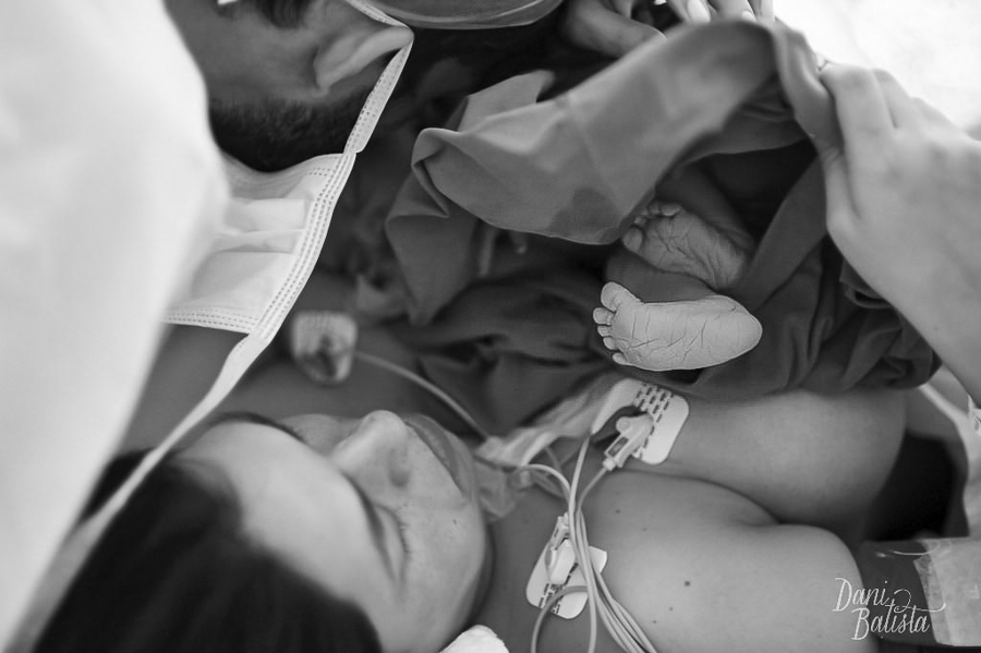 parto cesarea perinatal laranjeiras fotografia 