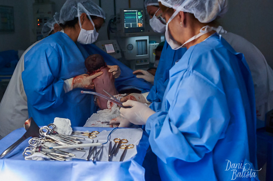 fotos de parto perinatal laranjeiras