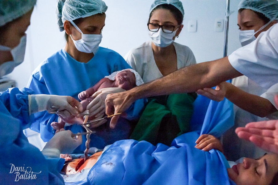 fotografia de parto cesarea perinatal