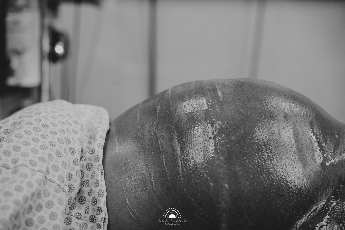 Fotografia de parto Cesária, Filme de parto, nascimento, humanização, vídeo de cesaria, cesariana humanizada, foto de parto Cesaria, parto humanizado, grande vitória, Vitoria Apart Hospital, parto Cesária, Meridional vitoria
