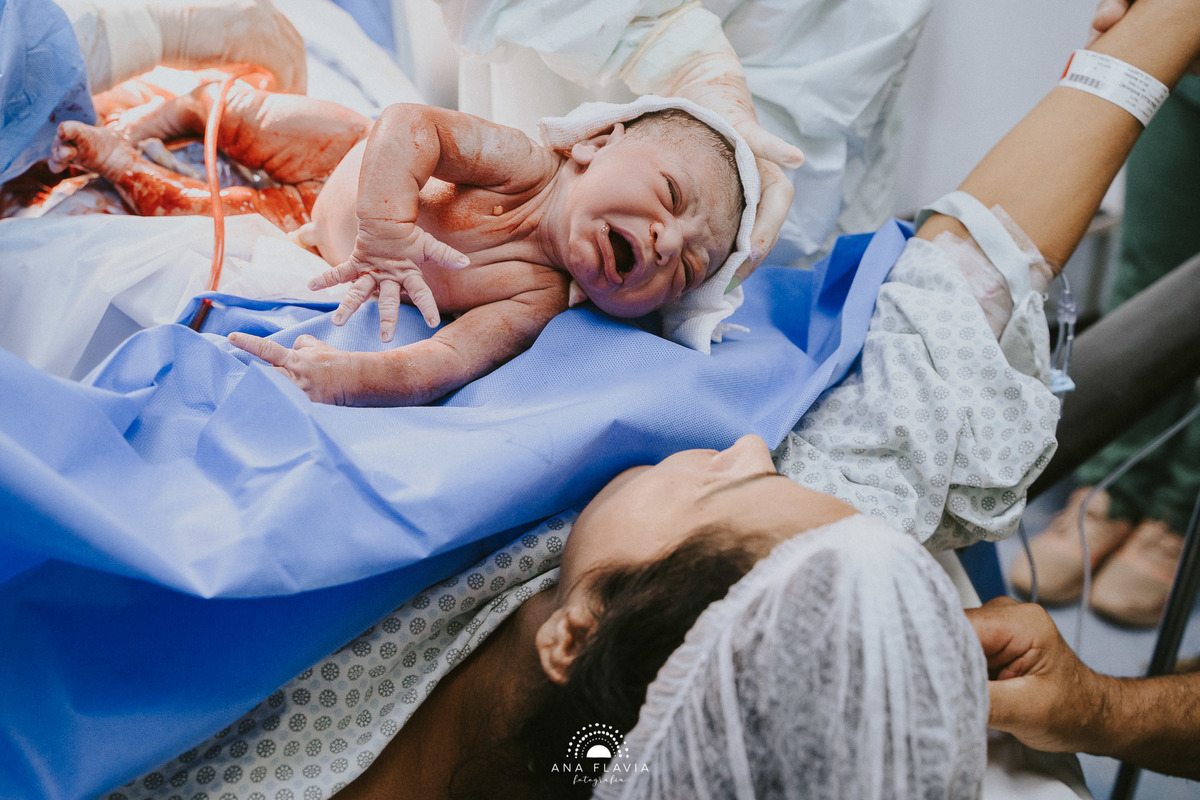 Fotografia de parto Cesária, Filme de parto, nascimento, humanização, vídeo de cesaria, cesariana humanizada, foto de parto Cesaria, parto humanizado, grande vitória, Vitoria Apart Hospital, parto Cesária, Meridional vitoria
