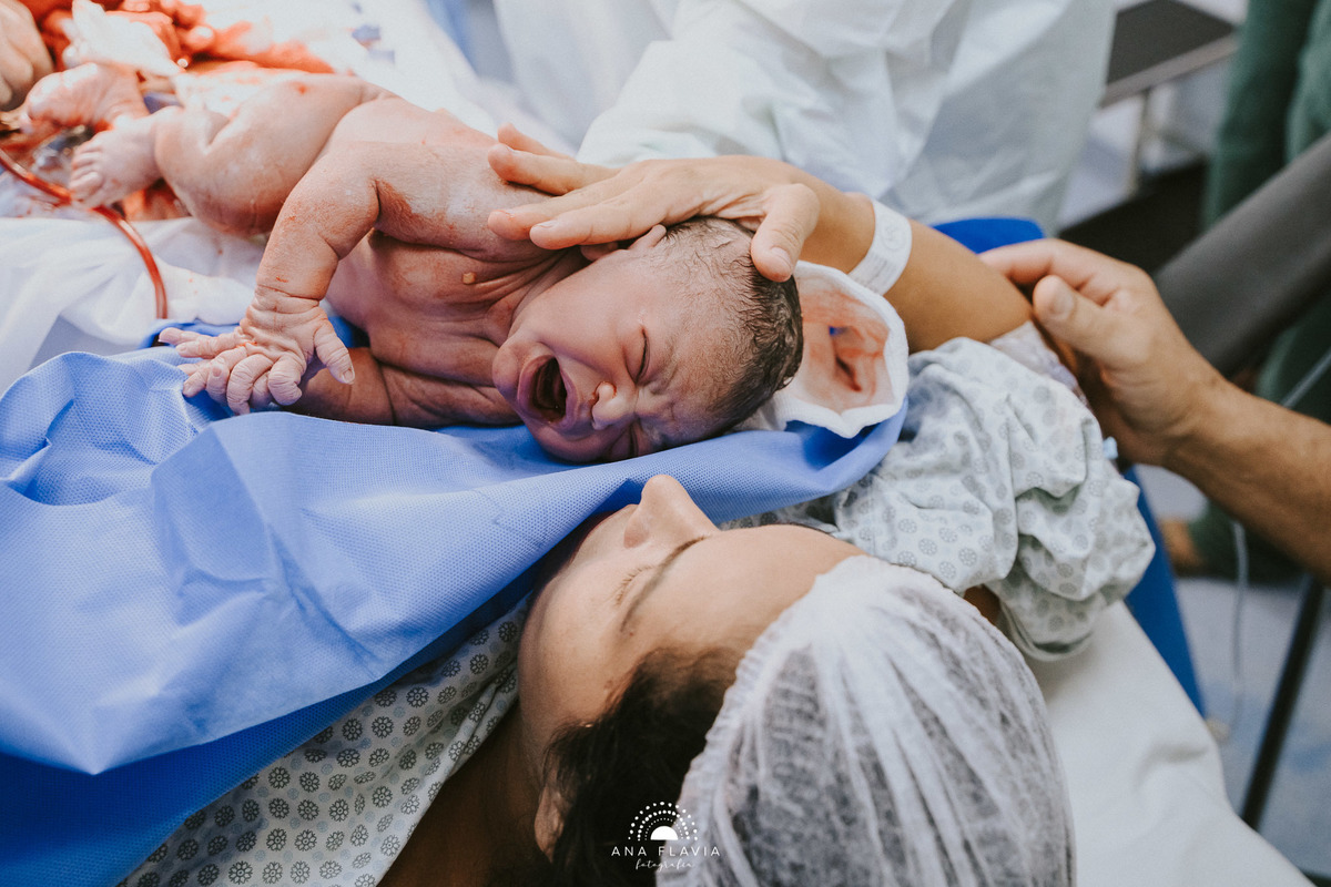 Fotografia de parto Cesária, Filme de parto, nascimento, humanização, vídeo de cesaria, cesariana humanizada, foto de parto Cesaria, parto humanizado, grande vitória, Vitoria Apart Hospital, parto Cesária, Meridional vitoria
