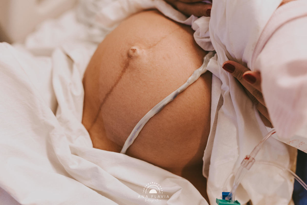 Filmes de parto, filmes de nascimento, nascimento, humanização, parto normal, cesariana humanizada, doula, parto, foto de parto, fotografia de parto no es, parto humanizado, grande vitória, maternidade Unimed vitoria, Parto Empelicado