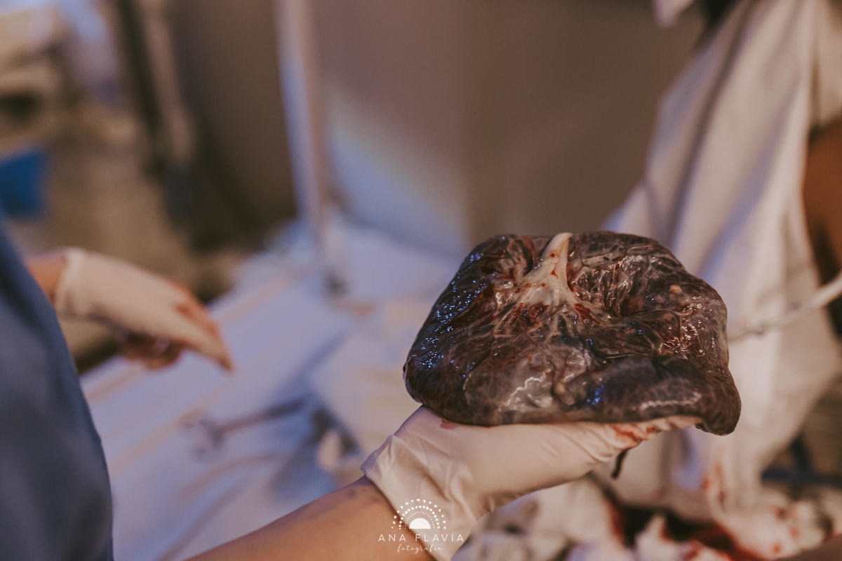 Filmes de parto, filmes de nascimento, nascimento, humanização, parto normal, cesariana humanizada, doula, parto, foto de parto, fotografia de parto no es, parto humanizado, grande vitória, maternidade Unimed vitoria, Parto Empelicado