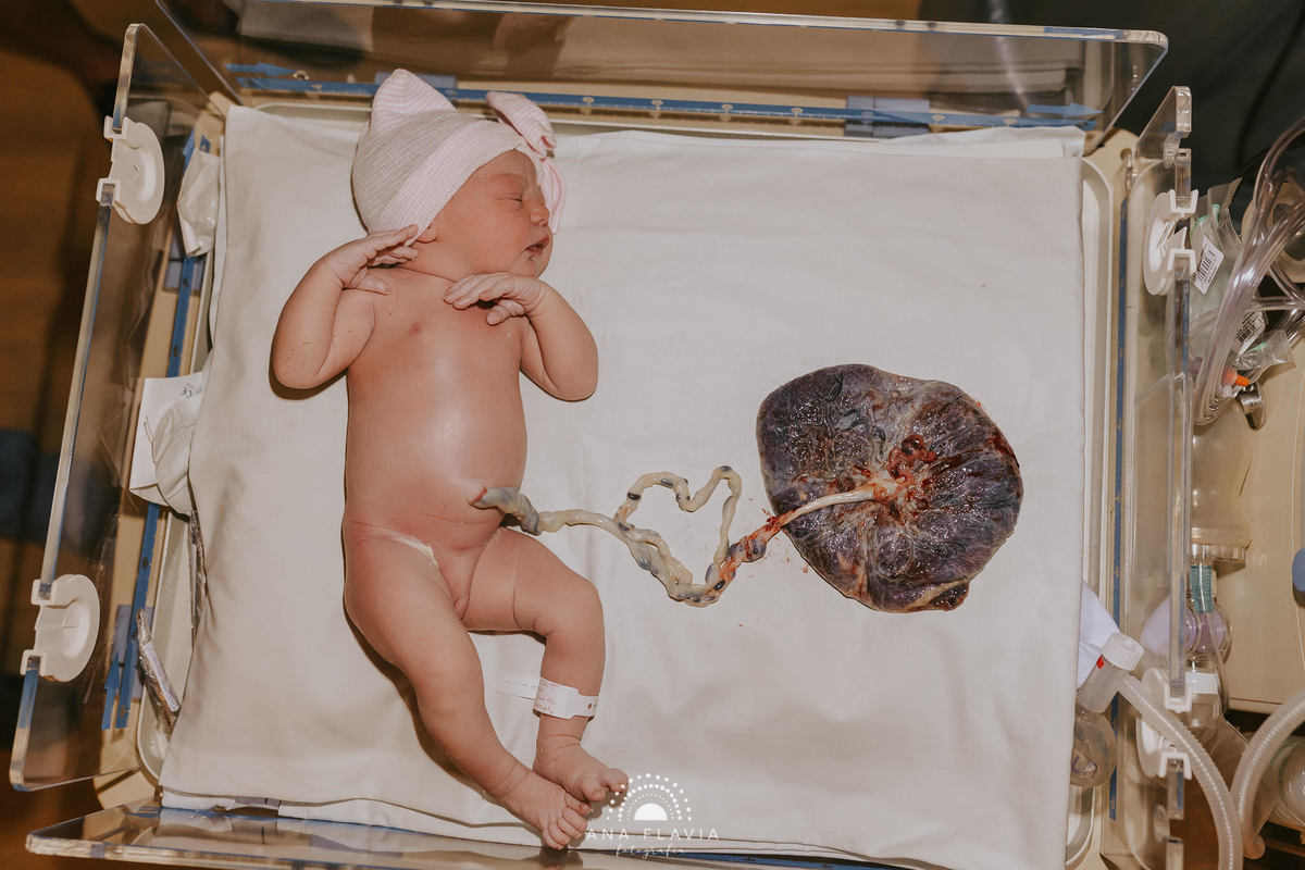 Filmes de parto, filmes de nascimento, nascimento, humanização, parto normal, cesariana humanizada, doula, parto, foto de parto, fotografia de parto no es, parto humanizado, grande vitória, maternidade Unimed vitoria, Parto Empelicado