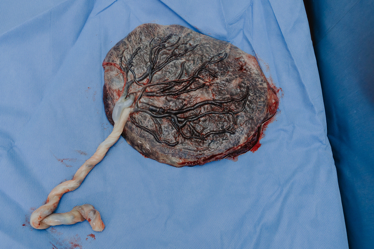 Fotografia de parto Cesária, Filme de parto, nascimento, humanização, vídeo de cesaria, cesariana humanizada, foto de parto Cesaria, parto humanizado, grande vitória, Vitoria Apart Hospital, parto Cesária, Cesária, dr frederico 