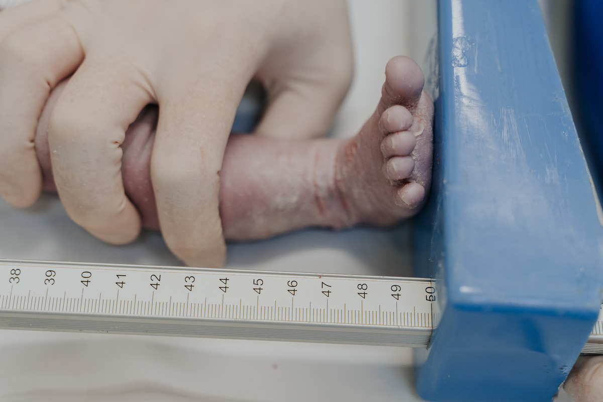 Fotografia de parto Cesária, Filme de parto, nascimento, humanização, vídeo de cesaria, cesariana humanizada, foto de parto Cesaria, parto humanizado, grande vitória, Vitoria Apart Hospital, parto Cesária, Cesária, dr frederico promatre