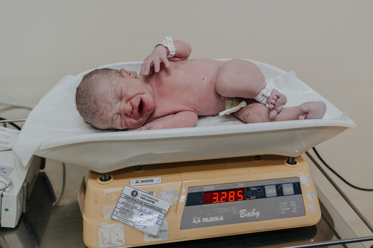 Fotografia de parto Cesária, Filme de parto, nascimento, humanização, vídeo de cesaria, cesariana humanizada, foto de parto Cesaria, parto humanizado, grande vitória, Vitoria Apart Hospital, parto Cesária, Cesária, dr frederico promatre