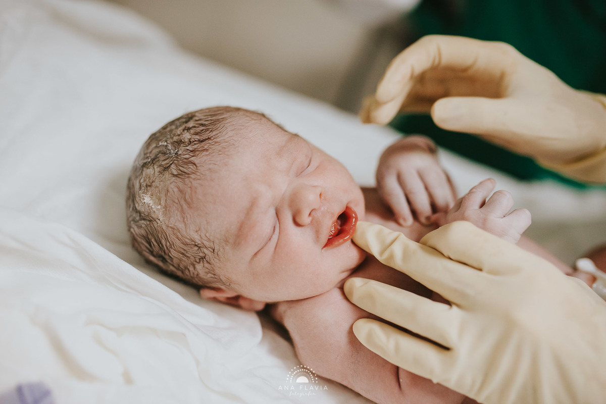 Fotografia de parto Cesária Filmes de parto, filmes de nascimento, nascimento, humanização, parto normal, cesariana humanizada, doula, parto, foto de parto, fotografia de parto no es, parto humanizado, grande vitória, vitoria apart hospital