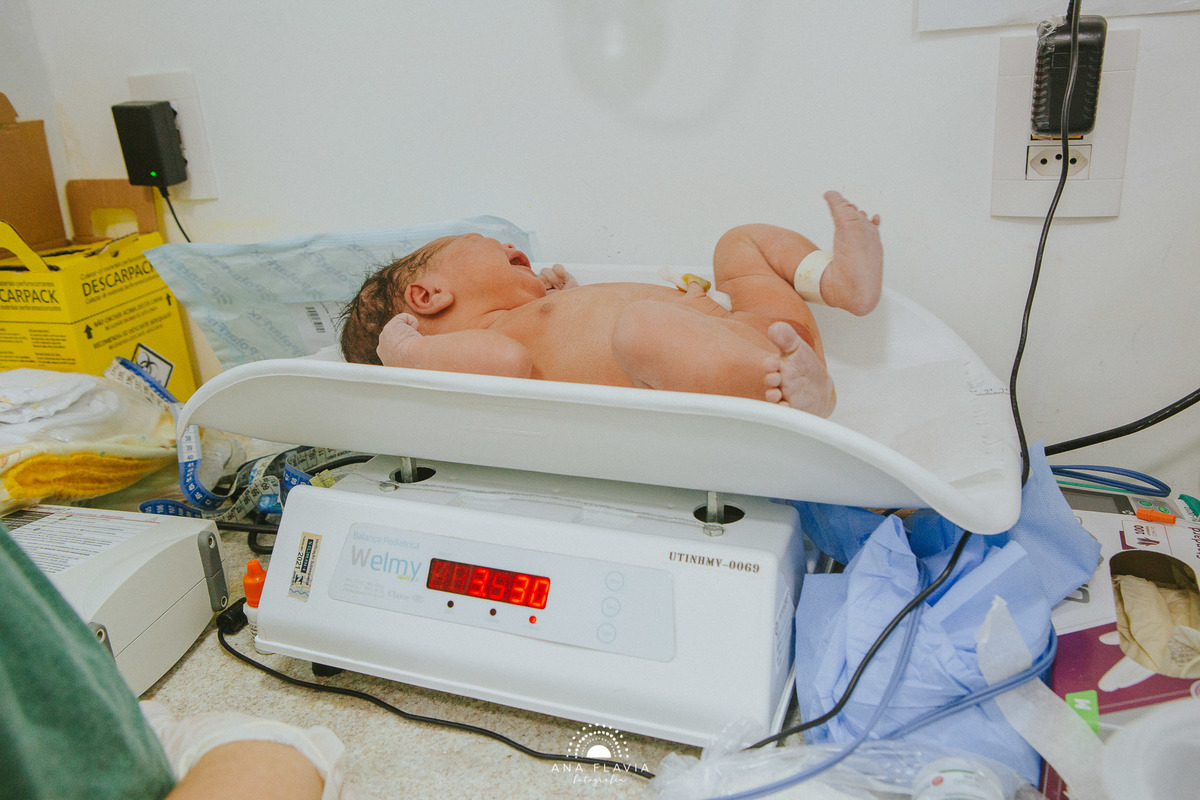 Fotografia de parto Cesária, Filme de parto, nascimento, humanização, vídeo de cesaria, cesariana humanizada, foto de parto Cesaria, parto humanizado, grande vitória, Hospital Praia da Costa, parto Cesária, parto normal, santa ursula