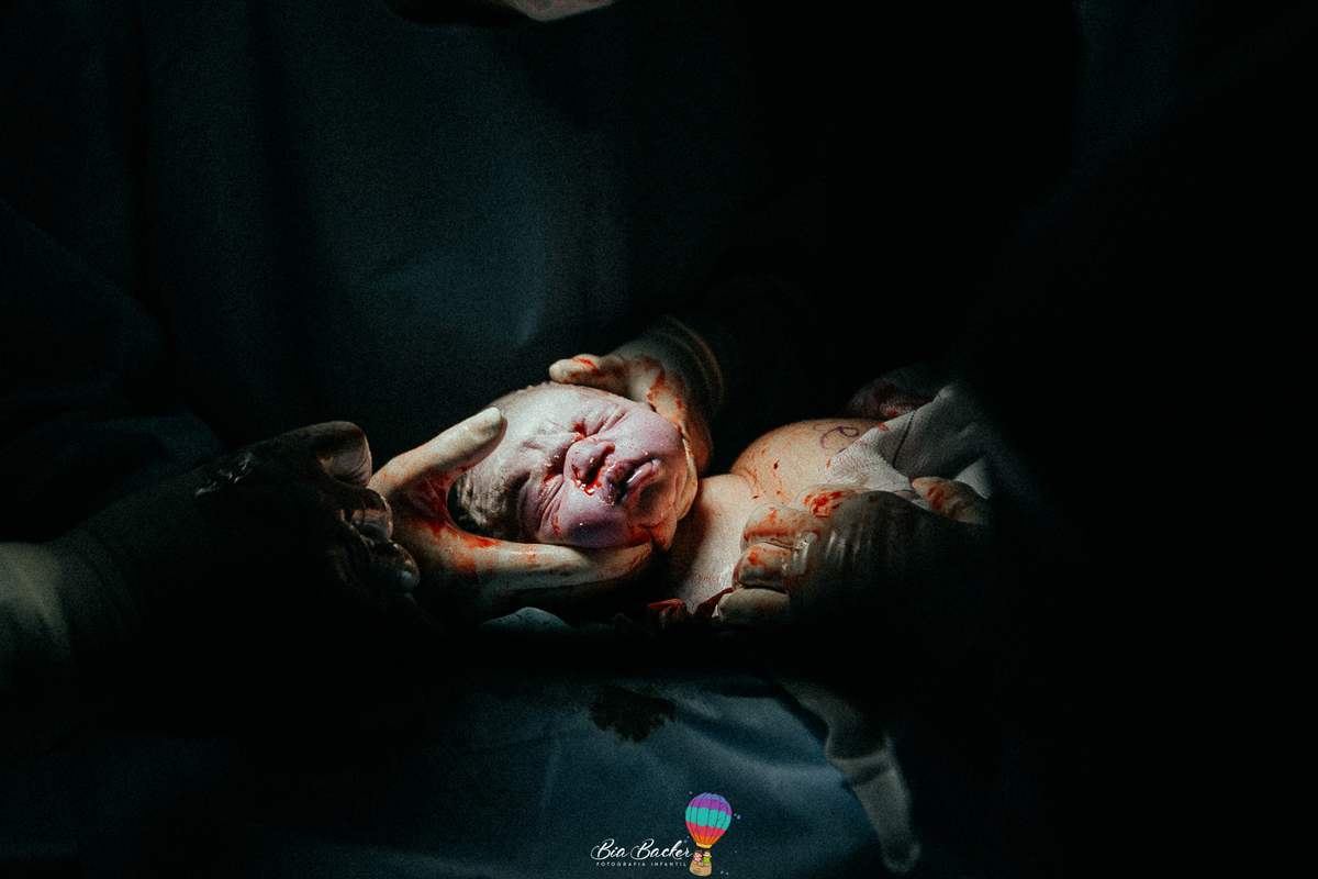 fotografia de parto rj parto humanizado Hospital Pasteur RJ Equipe dra. Marina Peres RJ humanizado Hospital Pasteur RJ Equipe dra. Marina Peres RJ Nascimento de Miguel