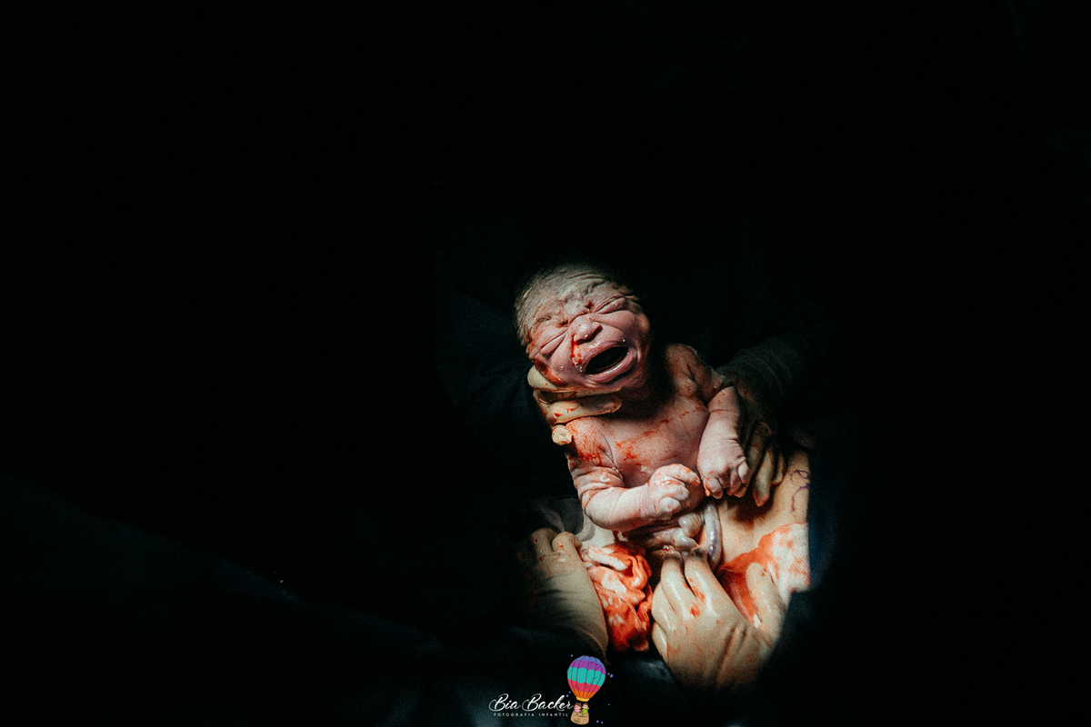 fotografia de parto rj parto humanizado Hospital Pasteur RJ Equipe dra. Marina Peres RJ humanizado Hospital Pasteur RJ Equipe dra. Marina Peres RJ Nascimento de Miguel