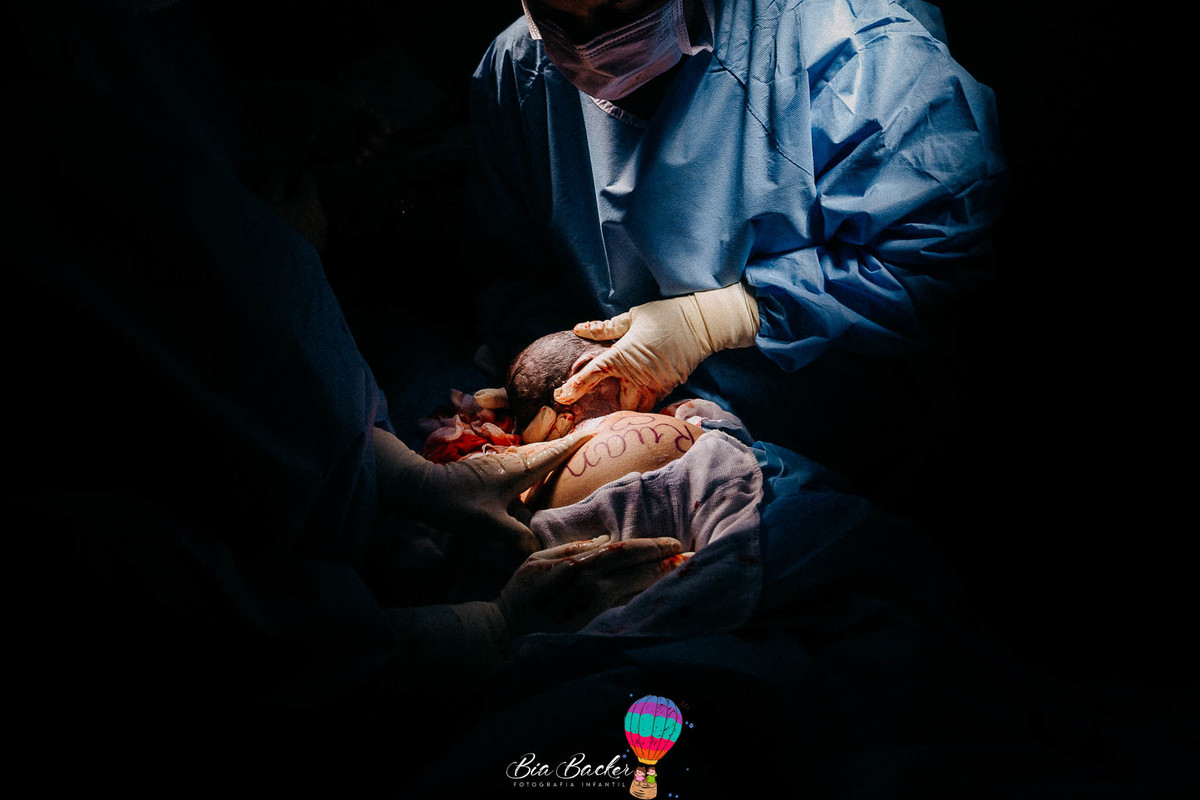 nascimento do Ruan fotografia de parto rj dra. Marina Peres Hospital Pasteur rj