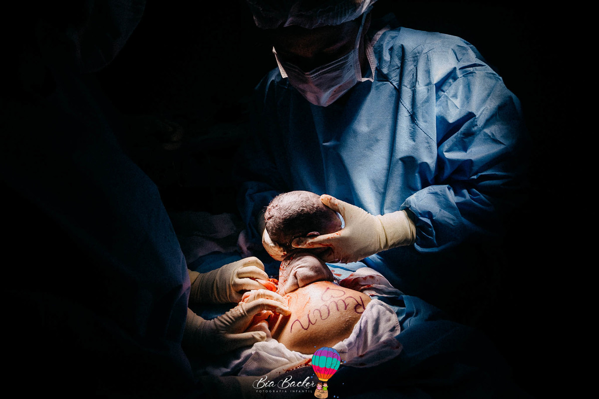 nascimento do Ruan fotografia de parto rj dra. Marina Peres Hospital Pasteur rj