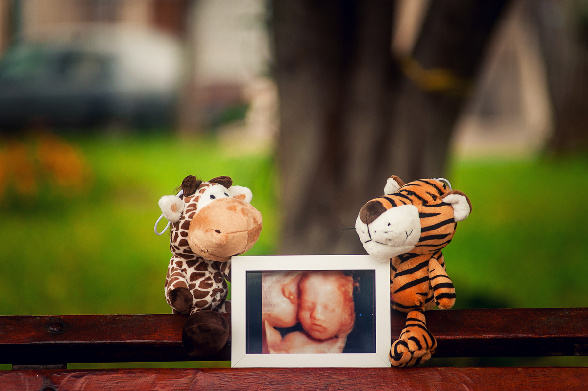Ecografía,, cuadro de ecografia, peluche, tigre de peluche, jirafa de peluche, sesión de fotos para embarazadas, sesión de fotos para embarazadas