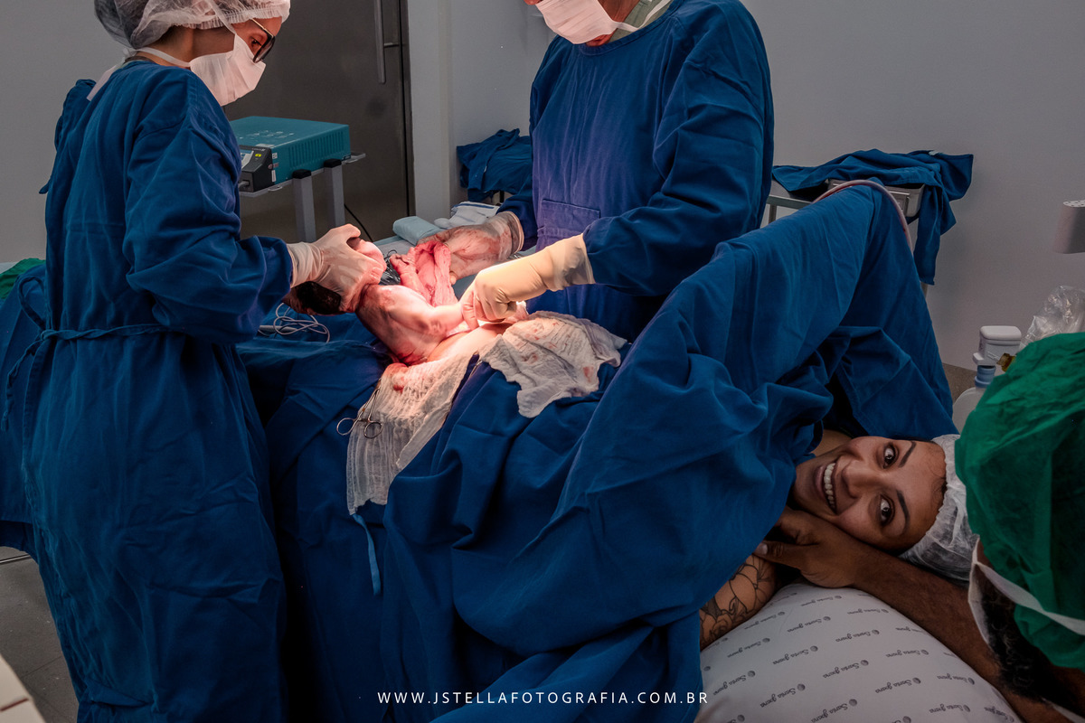 fotografia de parto cesárea