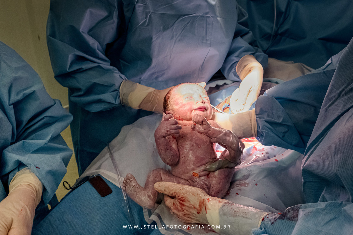 fotografia de parto